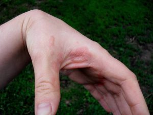 مضرات جوهرنمک برای لوله